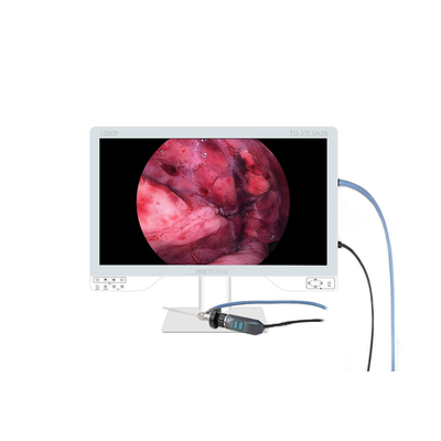 Últimas notícias da empresa sobre Câmeras de Endoscopia Portáteis – Trazendo Precisão e Flexibilidade para Diagnósticos Modernos