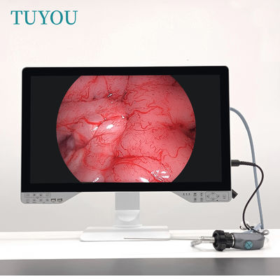 comprar Disco U 27 polegadas 1080P Full HD 4 em 1 Sistema de Artroscópio Médico Histeroscopo Endoscópio Câmera fabricação em linha