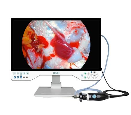 comprar Sistema de Câmera de ENT tudo em um com Câmera portátil de Endoscópio HD e Fonte de Luz fabricação em linha