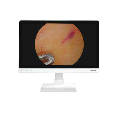 comprar 4K FHD Equipamento Médico 27 polegadas Endoscópio Display de monitor de câmera para endoscópio fabricação em linha