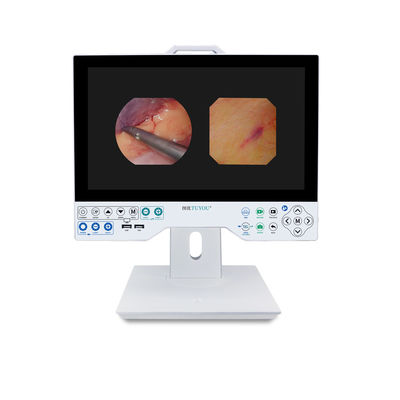 comprar TUYOU Full HD 1080P 15,6 polegadas All In One Sistema de Câmera de Endoscopia Médica para ENT Sinus Urologia fabricação em linha