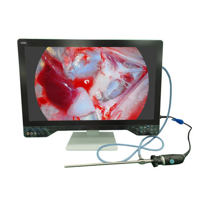 comprar Ultra High Definition Endoscope Camera 4K para Laparoscopia com monitor de 32