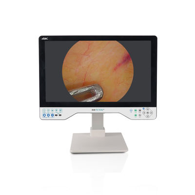 comprar 24 polegadas monitor laparoscópico 4K UHD Endoscópio Sistema de câmera LED cirúrgico com fonte de luz fabricação em linha