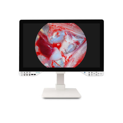 comprar Câmera de endoscópio médico de 27