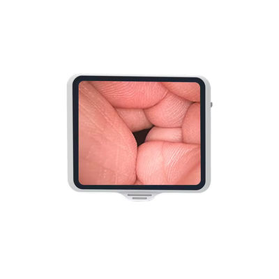 comprar Endoscópio flexível de classe I TUYOU com tela de 3,5 polegadas reutilizável para zoom de broncoscopia de fibra óptica fabricação em linha