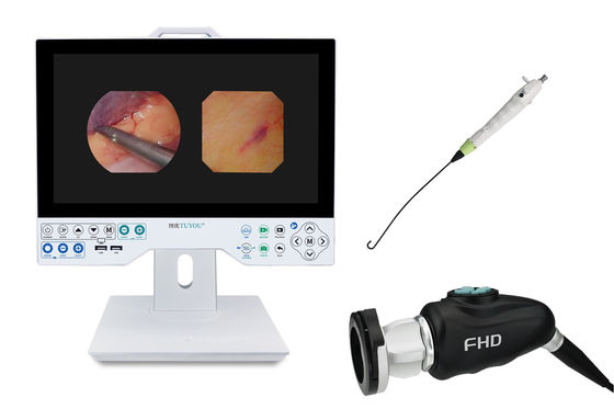 comprar TUYOU Ferramenta de Cirurgia do Cérebro All-in-One Sistema de Câmera de Endoscopia Rígida e Flexível para Exames Uterinos fabricação em linha