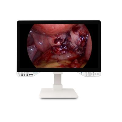 comprar 27 polegadas FHD 1080P Endoscópico Sistema de Câmera Somente Endoscópio rígido com monitor e potência óptica efetiva de 100W fabricação em linha