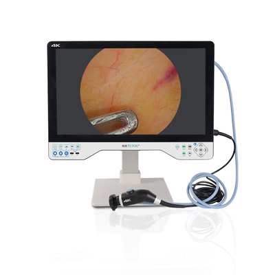 comprar TU-24LSD1A 4K 24 polegadas 4K Endoscopia Médica Câmera com 8h Bateria IPX8 fabricação em linha