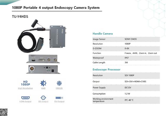 comprar TUYOU TU-Y4HDS 1080P Portable Medical Endoscope Camera with HDMI/CVBS fabricação em linha