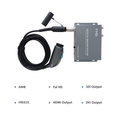 comprar Wireless Portable Endoscope Camera System - High Resolution for ENT/Orthopedics Clinical Examination fabricação em linha