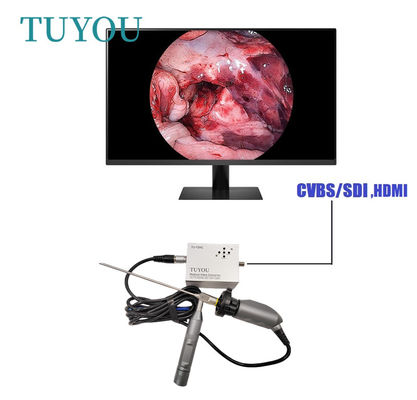 Full HD Eletrônica Portátil Endoscopia ENT Câmera Médica Para Computador Portátil
