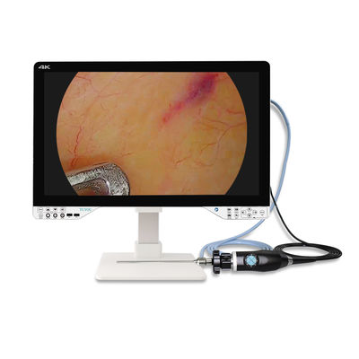 Endoscópio 4K de 27 polegadas para cirurgia laparoscópica com fonte de luz e monitor