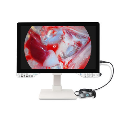 Inovador Kit de Câmera de Endoscópio Cirúrgico Full HD Com Fonte de Luz e Monitor de 27' Para Ginecologia