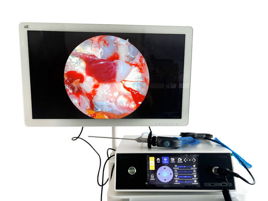 Câmera portátil de endoscopia ENT Full HD 1080P com tela sensível ao toque e fonte de luz LED