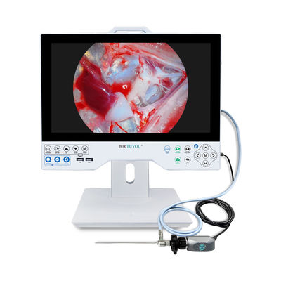 Monitor LCD portátil All in One HD Endoscope Camera para ENT/Laparoscopia/Histeroscopia/Urologia