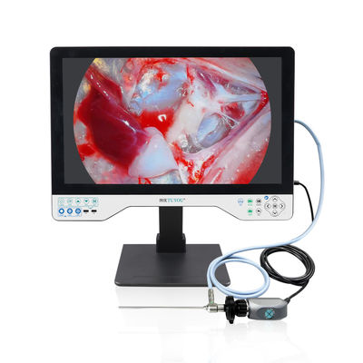 Factory Direct 24' All-in-One HD Endoscope Camera System para ENT, Urologia e Laparoscopia endoscopia