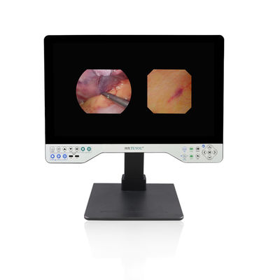 1080P Full HD Endoscópio Sistema rígido e flexível 24 polegadas tudo em um vídeo gravador câmera