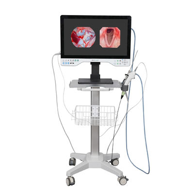FHD sistema de câmera de endoscópio tudo em um LED Light & Flexível abrangência para laparoscopia