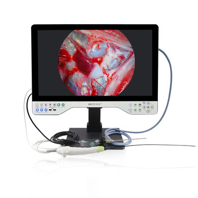 Seleção do modo de monitoramento de 15 polegadas TUYOU All-in-One Medical Endoscope Camera com fonte de luz para urologia e ginecologia