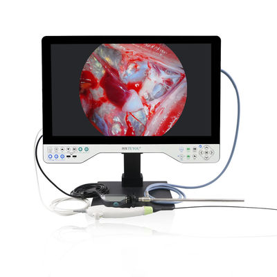 TUYOU 1080P Sistema de câmera endoscópico rígido e flexível multifuncional para laparoscopia