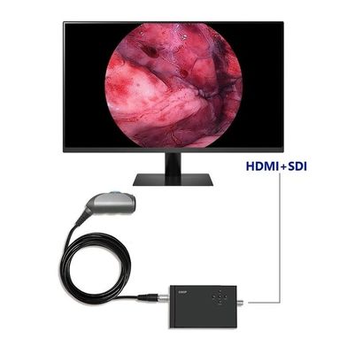 Fotocamera de vídeo portátil de endoscopia TUYOU Full HD 1920x1080 Resolução 120 graus Campo de visão para Urologia Espinha e Cirurgia ENT
