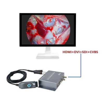 Fabricação TUYOU Câmera de endoscopia de imagem médica portátil integrada 1080P para cirurgia nasal e de animais de estimação