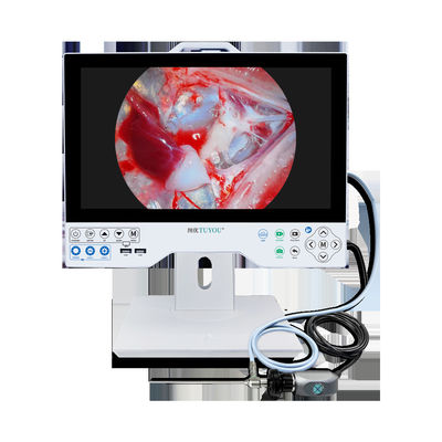 15.6 polegadas Full HD sistema de câmera de endoscopia de imagem cirúrgica tudo em um com função de chave Shoutcut