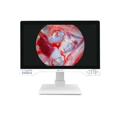 Câmera de endoscopia 4K avançada de 32 polegadas com fonte de luz integrada e tela para sistema laparoscópico