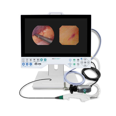 TUYOU Ferramenta de Cirurgia do Cérebro All-in-One Sistema de Câmera de Endoscopia Rígida e Flexível para Exames Uterinos