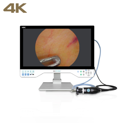 Sistema de câmera de endoscopia FHD TUYOU All-in-One com monitor cirúrgico de 24