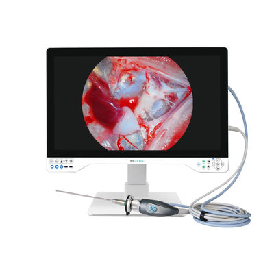 32-inch 4K Medical Endoscope Camera with 8-Hour Battery Life