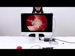 24in TUYOU Nasofaringoscope Endoscope Camera Recorder para cirurgias de laparoscopia de alta definição