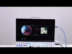 TUYOU 15.6 Full HD 1080P Inch All In One Sistema de Câmera de Endoscopia Médica para ENT Sinus Urologia
